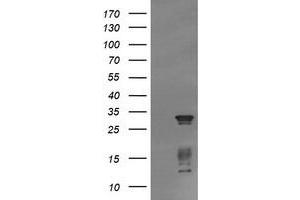 Image no. 2 for anti-Tripartite Motif Containing 38 (TRIM38) (AA 1-265) antibody (ABIN1490682) (TRIM38 Antikörper  (AA 1-265))