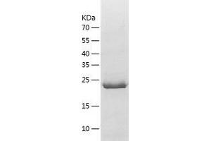 Western Blotting (WB) image for Nuclear Receptor Binding SET Domain Protein 1 (NSD1) (AA 1849-2094) protein (His tag) (ABIN7124211) (NSD1 Protein (AA 1849-2094) (His tag))