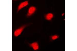 Immunofluorescent analysis of PTTG1/2/3 staining in Jurkat cells.