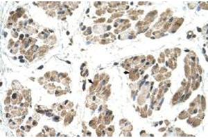 Immunohistochemical staining (Formalin-fixed paraffin-embedded sections) of human muscle with FKTN polyclonal antibody  at 4-8 ug/mL working concentration. (Fukutin Antikörper  (N-Term))