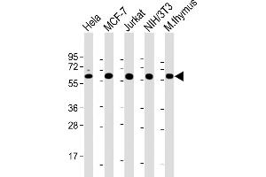 All lanes : Anti-Hsp60 Antibody at 1:2000 dilution Lane 1: Hela whole cell lysate Lane 2: MCF-7 whole cell lysate Lane 3: Jurkat whole cell lysate Lane 4: NIH/3T3 whole cell lysate Lane 5: mouse thymus lysate Lysates/proteins at 20 μg per lane. (HSPD1 Antikörper  (AA 340-374))