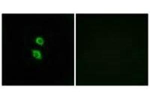 Immunofluorescence analysis of MCF-7 cells, using ARSD antibody. (Arylsulfatase D Antikörper)
