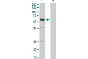 Western Blot analysis of ARHGEF5 expression in transfected 293T cell line by ARHGEF5 monoclonal antibody (M01), clone 3A12-B5. (ARHGEF5 Antikörper  (AA 1-519))