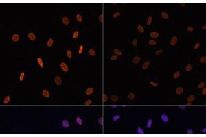 Immunofluorescence analysis of NIH/3T3 cells using Acetyl-Histone H2B-K12 Polyclonal Antibody at dilution of 1:100.