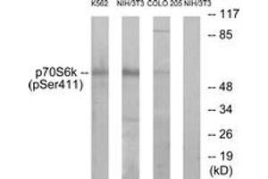 Western Blotting (WB) image for anti-Ribosomal Protein S6 Kinase, 70kDa, Polypeptide 1 (RPS6KB1) (pSer411) antibody (ABIN2888505) (RPS6KB1 Antikörper  (pSer411))