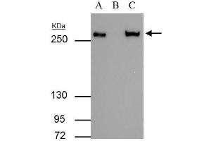 IP Image FASN antibody immunoprecipitates FASN protein in IP experiments.