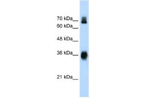 WB Suggested Anti-KEAP1 Antibody Titration:  1. (KEAP1 Antikörper  (C-Term))