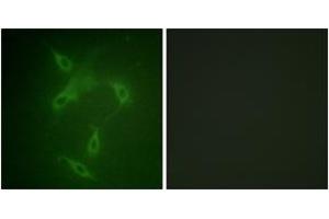 Immunofluorescence analysis of NIH-3T3 cells, using JAK2 (Ab-570) Antibody. (JAK2 Antikörper  (AA 541-590))