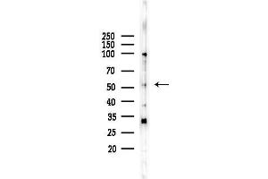 Western blot analysis of lysates from Hela cells(heat-shock,45 min treatment), using MS/STK4 Antibody at 1/1000 dilution.