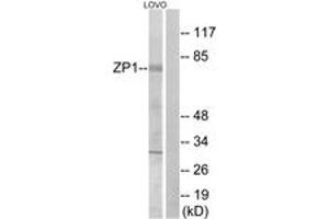 Western blot analysis of extracts from LOVO cells, using ZP1 Antibody. (ZP1 Antikörper  (AA 221-270))