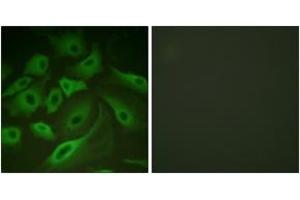 Immunofluorescence analysis of HeLa cells, using PLB (Ab-16/17) Antibody. (Phospholamban Antikörper  (AA 1-50))