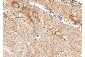 ABIN6268819 at 1/100 staining human brain tissue sections by IHC-P. (EPH Receptor B4 Antikörper  (Internal Region))