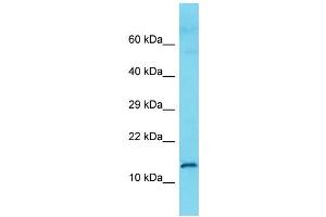 Host: Rabbit Target Name: C9orf57 Sample Type: Fetal Kidney lysates Antibody Dilution: 1.