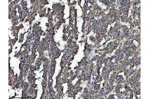 IHC analysis of DBN1 using anti-DBN1 antibody (ABIN7602637).