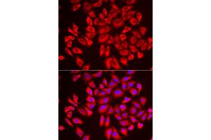 Immunofluorescence analysis of U2OS cells using DCAF7 antibody (ABIN6293269).