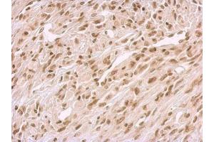 IHC-P Image BCCIP antibody detects BCCIP protein at nucleus on U373 xenograft by immunohistochemical analysis. (BCCIP Antikörper  (C-Term))