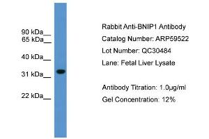 WB Suggested Anti-BNIP1  Antibody Titration: 0. (BNIP1 Antikörper  (N-Term))