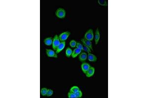 Immunofluorescent analysis of PC-3 cells using ABIN7164210 at dilution of 1:100 and Alexa Fluor 488-congugated AffiniPure Goat Anti-Rabbit IgG(H+L) (PFDN2 Antikörper  (AA 1-154))