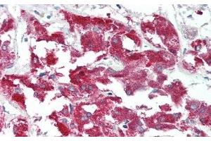 Immunohistochemistry (IHC) image for anti-C-Mer Proto-Oncogene Tyrosine Kinase (MERTK) (AA 587-858) antibody (ABIN7435775)