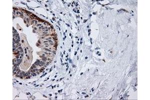 Immunohistochemistry (IHC) image for anti-Induced Myeloid Leukemia Cell Differentiation Protein Mcl-1 (MCL1) antibody (ABIN1499338) (MCL-1 Antikörper)