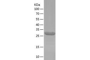 Western Blotting (WB) image for AHA1, Activator of Heat Shock 90kDa Protein ATPase Homolog 2 (AHSA2) (AA 1-299) protein (His tag) (ABIN7121757) (AHSA2 Protein (AA 1-299) (His tag))