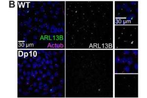 Primary cilium formation in hTERT-RPE1 cells treated with siRNA: control (a), UBQLN4 (b), BAG6 (c), and RNF126 (d). (ARL13B Antikörper  (C-Term))