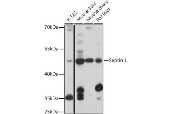 Septin 1 anticorps  (AA 270-370)