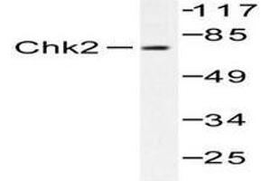Image no. 1 for anti-Checkpoint Kinase 2 (CHEK2) antibody (ABIN265350) (CHEK2 Antikörper)