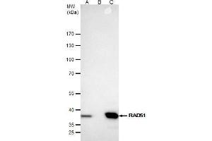 IP Image Rad51 antibody [N1C2] immunoprecipitates Rad51 protein in IP experiments. (RAD51 Antikörper  (Center))