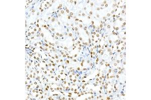 Immunohistochemistry of paraffin-embedded rat kidney using Phospho-Histone H3. (Histone H3.3 Antikörper  (pSer31))