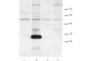 AID antibody (mAb) tested by Western blot. (AICDA Antikörper  (AA 178-198))