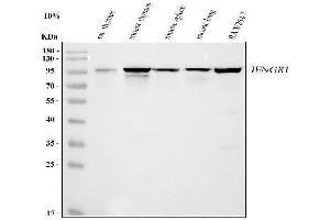 Western blot analysis of Ifngr1 using anti-Ifngr1 antibody (ABIN7599858).