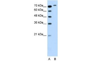 RHOBTB1 antibody used at 0. (RHOBTB1 Antikörper  (Middle Region))