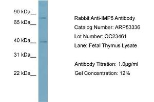 WB Suggested Anti-IMP5  Antibody Titration: 0. (SPPL2C Antikörper  (Middle Region))