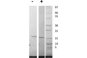 SDS-PAGE of Human Interleukin-11 Recombinant Protein SDS-PAGE of Human Interleukin-11 Recombinant Protein. (IL-11 Protein)