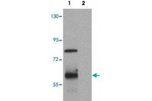 Western blot analysis of KAL1 in MCF-7 cell lysate with KAL1 polyclonal antibody  at 1 ug/mL. (KAL1 Antikörper  (Internal Region))