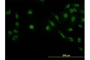 Immunofluorescence of monoclonal antibody to LDB2 on HeLa cell. (LIM Domain Binding 2 Protein Antikörper  (AA 1-373))