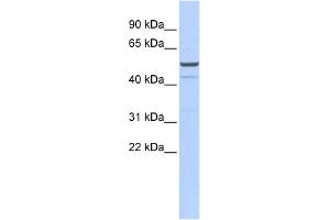 WB Suggested Anti-KCNK12 Antibody Titration:  0. (KCNK12 Antikörper  (Middle Region))
