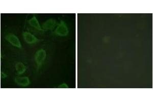 Immunofluorescence analysis of HeLa cells, using PECAM-1 (Phospho-Tyr713) Antibody. (CD31 Antikörper  (pTyr713))