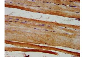 IHC image of ABIN7152365 diluted at 1:600 and staining in paraffin-embedded human skeletal muscle tissue performed on a Leica BondTM system. (EYA4 Antikörper  (AA 153-224))