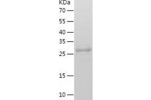 Western Blotting (WB) image for Secretagogin, EF-Hand Calcium Binding Protein (SCGN) (AA 2-276) protein (His tag) (ABIN7124998) (SCGN Protein (AA 2-276) (His tag))