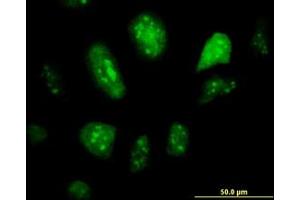 Image no. 2 for anti-Glial Cells Missing Homolog 1 (GCM1) (AA 108-166) antibody (ABIN599044) (GCM1 Antikörper  (AA 108-166))