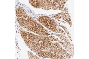 Immunohistochemical staining of human smooth muscle with ACTRT1 polyclonal antibody  shows strong cytoplasmic positivity in smooth muscle cells. (ACTRT1 Antikörper)