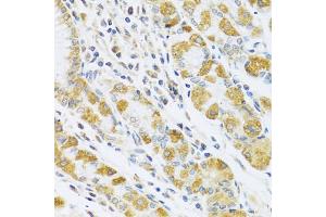 Immunohistochemistry of paraffin-embedded human stomach using PSG1 antibody (ABIN5973801) at dilution of 1/100 (40x lens). (PSG1 Antikörper)
