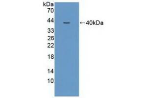 Detection of Recombinant NCOA3, Human using Polyclonal Antibody to Nuclear Receptor Coactivator 3 (NCOA3) (NCOA3 Antikörper  (AA 1023-1304))