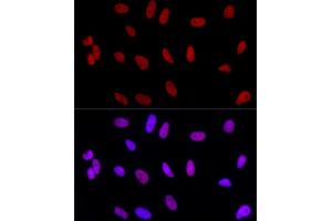 Immunofluorescence analysis of HeLa using AhR Rabbit mAb (ABIN7265679) at dilution of 1:100 (40x lens). (Aryl Hydrocarbon Receptor Antikörper)