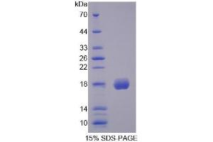 SDS-PAGE of Protein Standard from the Kit (Highly purified E. (CFP CLIA Kit)
