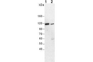 Western Blot of mouse kidney (lane 1) and brain (lane 2) using anti-α-Actinin-4, pAb (IG-701) . (alpha Actinin 4 Antikörper  (C-Term, N-Term))