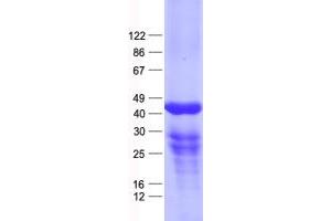 Western Blotting (WB) image for Dual Specificity Phosphatase 11 (RNA/RNP Complex 1-Interacting) (DUSP11) protein (His tag) (ABIN2719826)