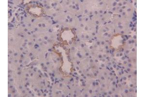 DAB staining on IHC-P; Samples: Rat Kidney Tissue (KRT6A Antikörper  (AA 323-461))